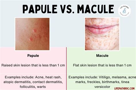 Papule vs Macule: Pictures, Differences, and Causes