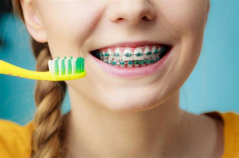 Brushing with Braces: How to Keep Your Braces Clean - Jiva Dental