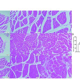 Cross-sectional muscle fiber diagram of the back muscles. (A) The cross ...