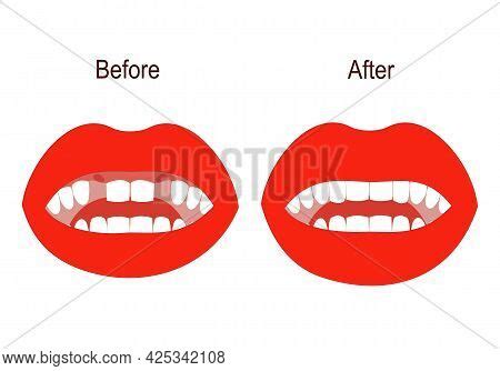 Dental Treatment Image & Photo (Free Trial) | Bigstock