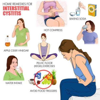 Interstitial Cystitis: 15 Natural Ways To Treat