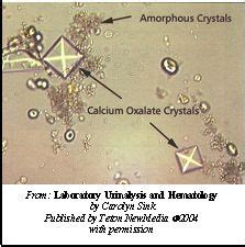 Crystals and amorphous sediment in urine! | Medical laboratory science, Medical lab technician ...