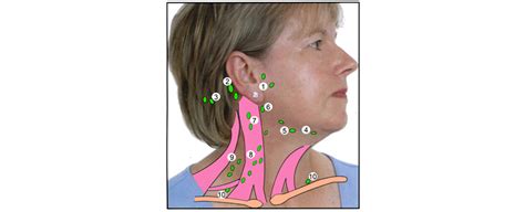 Swollen Lymph Nodes In Front Of Neck