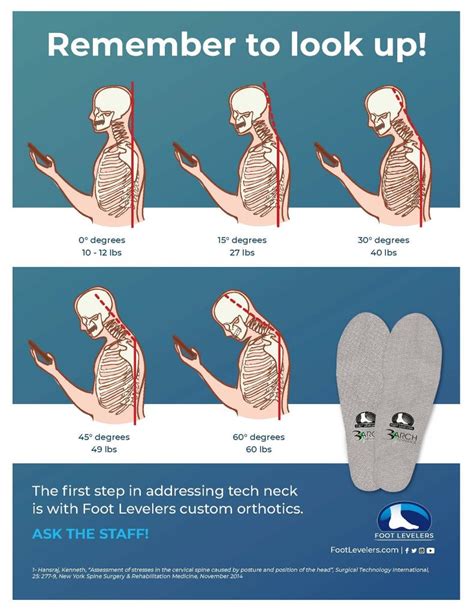 Forward Head Posture and Neck Pain (Cervical Kyphosis) | Foot Levelers