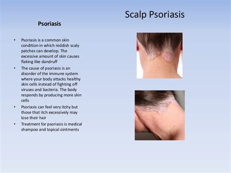 What are Common Causes of A Sore Scalp?