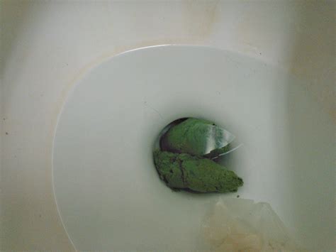 Anybody's poop ever get this green? : r/WTF