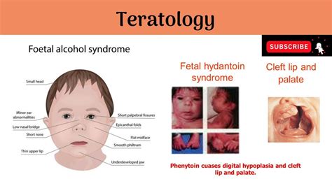 Teratology | Causes of Malformations | Mode of actions of Teratogens #Anatomy #mbbs #education ...