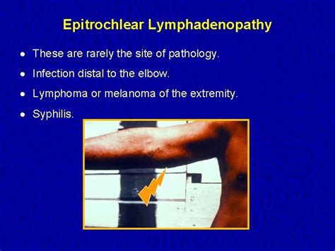 Lymph Nodes Examination Examination of the Lymphatic System