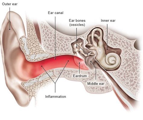 Swimmers Ear Diagram