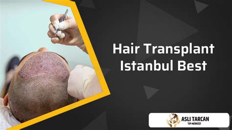 Hair Transplant Istanbul Best | Asli Tarcan Clinic