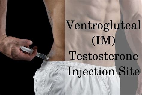 Intramuscular Injection Sites Testosterone