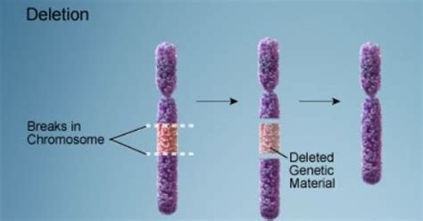 22q11.2 Deletion Syndrome - Hội chứng DieGeorge | Bác Sĩ Võ Tá Sơn