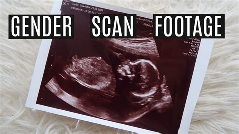 16 WEEK ULTRASOUND - GENDER SCAN FOOTAGE - FINDING OUT OUR BABY'S GENDER AT 16 WEEKS - YouTube