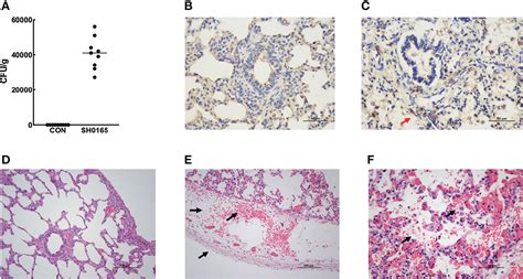 Visceral Pleura Histology