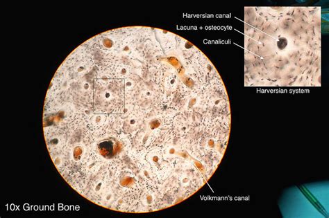 Bone Cells Under Microscope