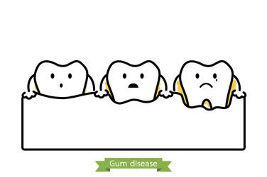 Gum Disease Vector Images (over 1,000)