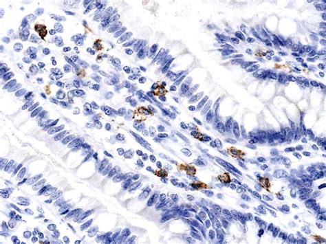 CD117 ( Mast cells) in human jejunum: FFPWS using dako a4502 | Histonet ...