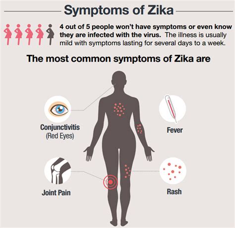 Zika virus infection history and symptoms - wikidoc