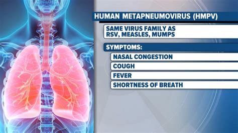 What to know about human metapneumovirus - Good Morning America