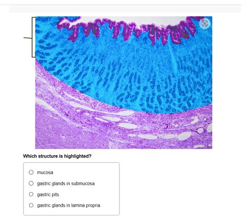 SOLVED: Which structure is highlighted? mucosa gastric glands in submucosa gastric pits gastric ...