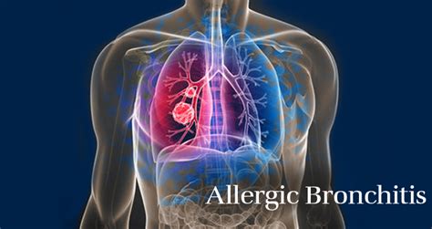 Allergic Bronchitis | Dr. Harmeen Bhatia