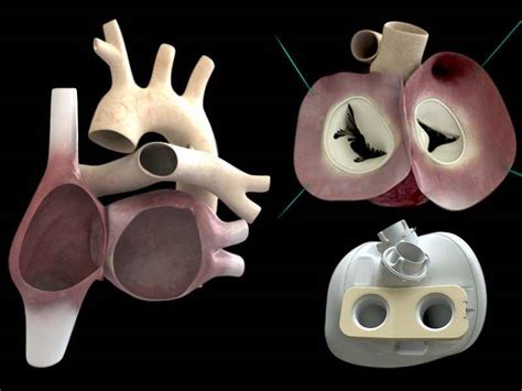 World's First Self Regulating Artificial Heart Succeeds Test