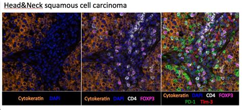 Multiplex immunofluorescence | CIO Tissue Biomarker Lab