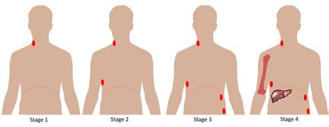 Haematology - TeachMePaediatrics