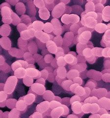 Streptococcus mitis