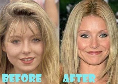 Kelly Ripa plastic surgery (18) – Celebrity plastic surgery online