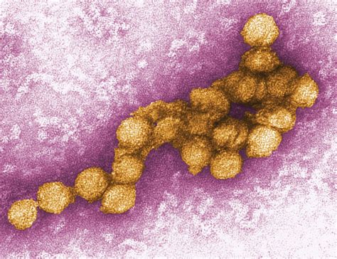 West Nile virus | Description, Transmission, Symptoms, & Treatment | Britannica