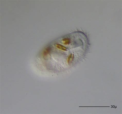 Free Images : drop, black and white, micro, moon, mikro, protist, protisten, einzeller, protozoa ...