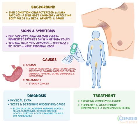 Acanthosis Nigricans: What Is It, Causes, Signs and Symptoms, and More ...