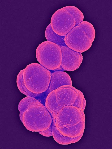 Methanotrophica Archaea Photograph by Science Photo Library - Pixels