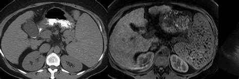 Abdominal Imaging - Subspecialties - Referring Physicians - UR Medicine Imaging Sciences ...