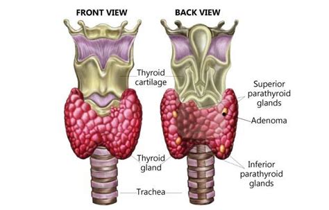 Parathyroid Adenoma: Symptoms, Treatment, Surgery, Recovery & Cost