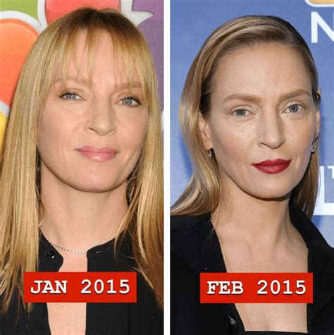 Uma Thurman before and after plastic surgery 04 | Celebrity plastic surgery online