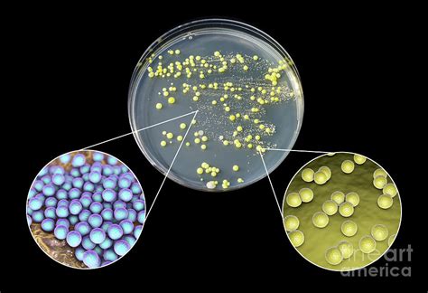 Bacterial Culture Grown From Human Skin Photograph by Kateryna Kon ...