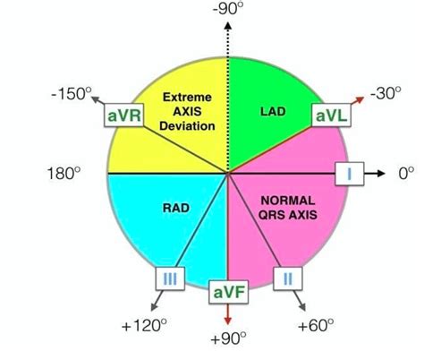 ECG interpretation - Rate - Rhythm - Cardiac Axis - TeachMePaeds