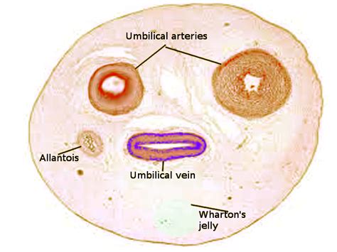 Anatomy, Abdomen and Pelvis, Umbilical Cord Article