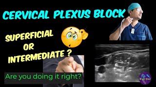 SUPERFICIAL CERVICAL PLEXUS BLOCK 🔴🔴 ULTRASOUND-GUIDE... | Doovi