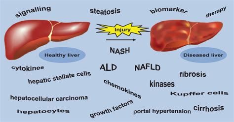 Signaling Pathways in Liver Disease