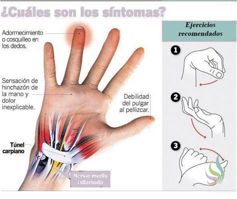 Tunel Metacarpiano De La Mano - SEONegativo.com