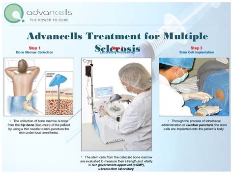 Multiple Sclerosis Treatment | Stem Cell Treatment for Multiple Scler…