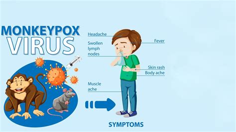 Mpox Disease Explained: Symptoms, Treatment, And Prevention | HerZindagi