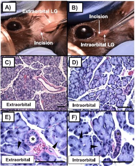 1. Extraorbital and Intraorbital Lacrimal Gland Histology from... | Download Scientific Diagram