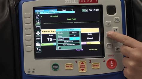 Transcutaneous Pacing Demonstration - YouTube