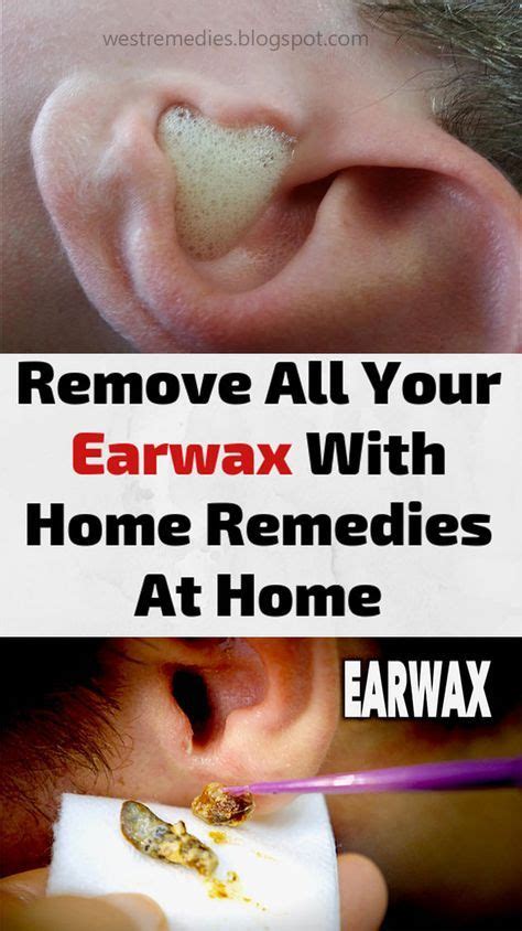 Remove All Your Earwax With Home Remedies At Home