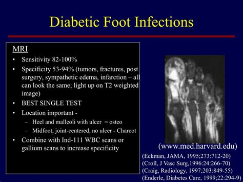 PPT - Bone and Joint Infections PowerPoint Presentation - ID:319537