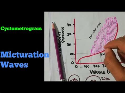 Cystometrogram | Micturition waves | Renal system 46 - YouTube